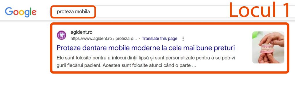 Rezultatele căutării Google pentru "proteza mobila" arată un rezultat de top despre protezele dentare moderne detașabile, cu o imagine a unei mâini care ține proteze dentare.